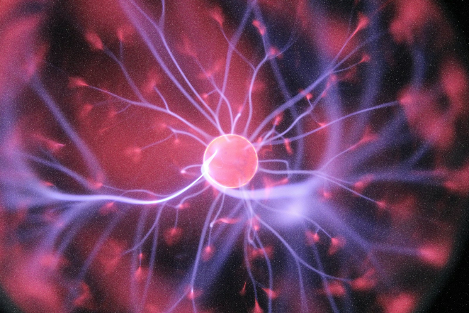 pink ball with purple synapses coming from it