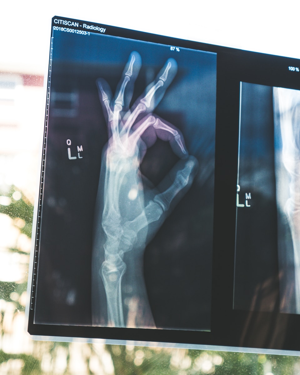 xray of hand doing ok gesture