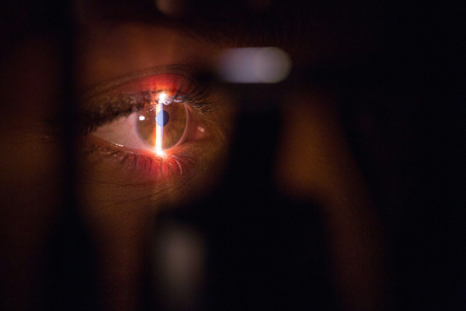 person having their eyes checked with light shining in eye